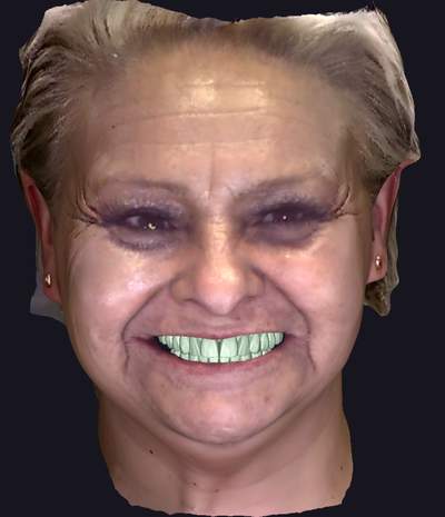 Paciente virtual 3D