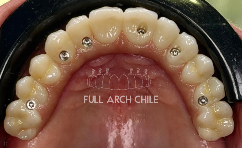 Caso 11