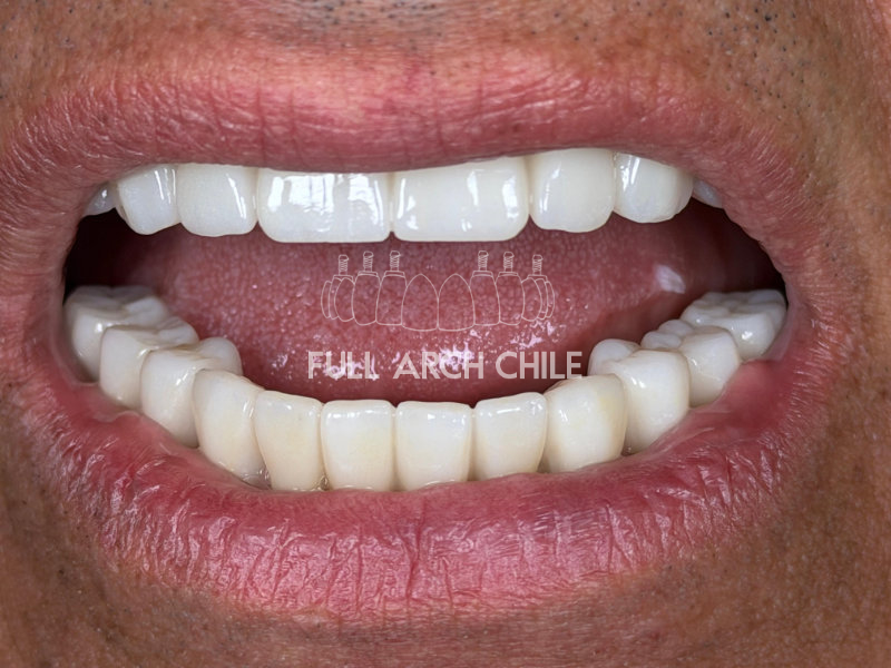 Caso 5